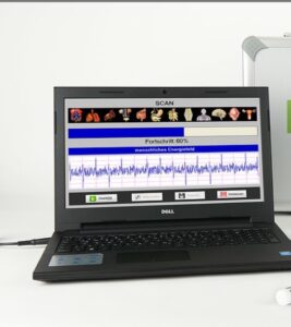 Bioscan
